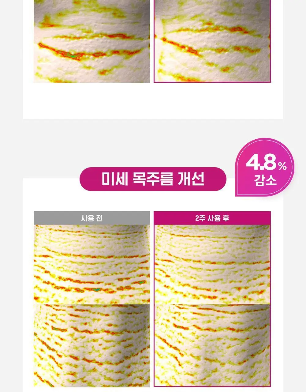 [160만개판매]CKD 레티노콜라겐 저분자 300 괄사 목주름 크림 50ml 1+1 기획 상세페이지 16